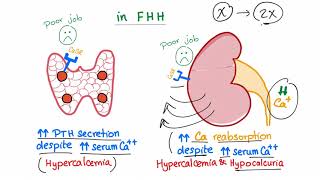 Familial Hypocalcuric Hypercalcemia FHH  Endocrinology and Nephrology [upl. by Osnohpla]