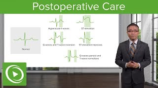 Postoperative Care – Surgery  Lecturio [upl. by Trueman976]