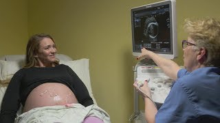 Ultrasounds during pregnancy [upl. by Ahsocin]