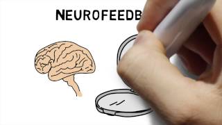 What is Neurofeedback [upl. by Gabrielson]