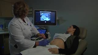 20 week ultrasound [upl. by Aneis]