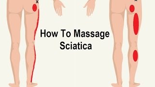 How To Reduce Sciatica Pain with Massage Trigger Point [upl. by Ocer424]