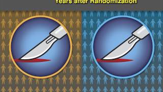 Dissection or Observation in Melanoma [upl. by Esiouqrut762]