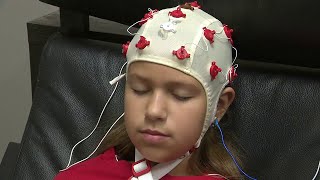 Brain treatment helps autism patients in Aventura [upl. by Garzon]