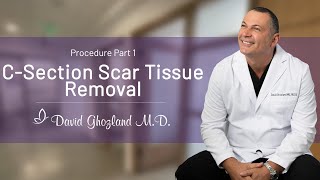 CSection Scar Tissue Removal  Procedure Part 1  David Ghozland MD [upl. by Enilrad694]