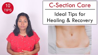 10 Tips to help Heal C Section wound  Post Delivery Care [upl. by Anagnos]