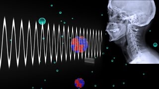 How Do Xrays Work [upl. by Onidranreb]