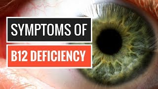 5 Signs and Symptoms of Vitamin B12 Deficiency [upl. by Lavelle]