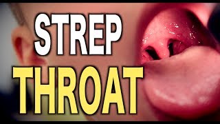 Strep Throat LIVE DIAGNOSIS [upl. by Nylyak865]