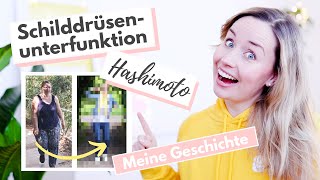 Schilddrüsenunterfunktion amp Hashimoto Meine Erfahrungen  wie geht es mir jetzt [upl. by Aratnahs369]