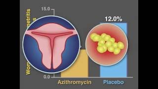 PostCesarean Infection and Antibiotic Prophylaxis  NEJM [upl. by Ainegue]